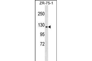 ERN1 Antibody (C-term) (ABIN1537620 and ABIN2849317) western blot analysis in ZR-75-1 cell line lysates (35 μg/lane). (ERN1 antibody  (C-Term))
