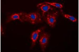 Immunofluorescent analysis of Caspase 7 p11 staining in HEK293T cells. (Caspase 7 p11 (Center) antibody)