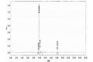 Image no. 3 for Proenkephalin (PENK) peptide (Ovalbumin) (ABIN5666163) (Proenkephalin (PENK) peptide (Ovalbumin))