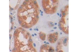 Figure. (EML2 antibody  (AA 375-649))