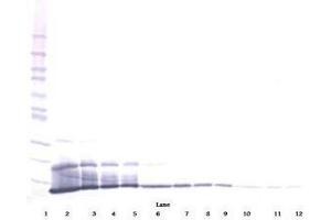 Image no. 1 for anti-Chemokine (C-X-C Motif) Ligand 16 (CXCL16) antibody (ABIN465413) (CXCL16 antibody)