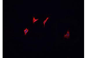 ABIN6266695 staining MCF-7 cells by IF/ICC. (HGS antibody  (Internal Region))