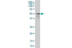 ZNF213 monoclonal antibody (M01), clone 5D7 Western Blot analysis of ZNF213 expression in A-431 .
