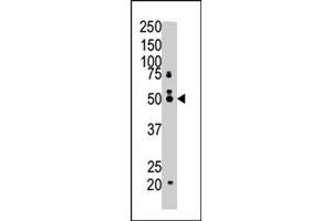 The FDFT1 polyclonal antibody  is used in Western blot to detect FDFT1 in mouse cerebellum tissue lysate . (FDFT1 antibody  (N-Term))