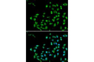 Immunofluorescence analysis of U20S cell using CTNNBL1 antibody. (CTNNBL1 antibody)