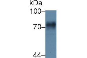 Detection of F1+2 in Rat Liver lysate using Polyclonal Antibody to Prothrombin Fragment 1+2 (F1+2) (Prothrombin Fragment 1+2 antibody  (AA 44-323))