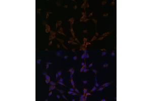 Immunofluorescence analysis of NIH/3T3 cells using DYNLL2 antibody (ABIN6130318, ABIN6139893, ABIN6139895 and ABIN6218049) at dilution of 1:100. (DYNLL2 antibody  (AA 1-89))