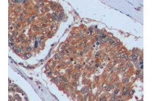Immunohistochemistry (IHC) image for anti-Fibronectin (AA 1998-2106) antibody (ABIN7437083)