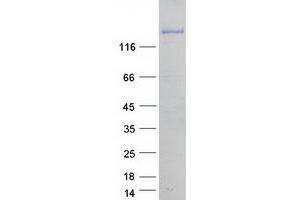 Validation with Western Blot (FAM21C Protein (Transcript Variant 3) (Myc-DYKDDDDK Tag))