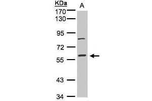 WB Image Sample(30 ug whole cell lysate) A:Hep G2 , 7. (MAPK8IP1 antibody)