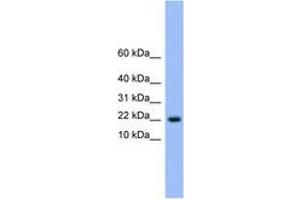 Image no. 1 for anti-NTF2-Related Export Protein 1 (NXT1) (AA 41-90) antibody (ABIN6745580) (NXT1 antibody  (AA 41-90))