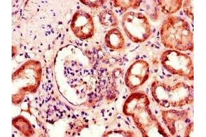 Immunohistochemistry of paraffin-embedded human kidney tissue using ABIN7145231 at dilution of 1:100 (BBS1 antibody  (AA 217-417))