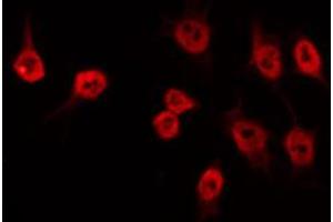 ABIN6274533 staining Hela by IF/ICC. (HMG20B antibody  (N-Term))
