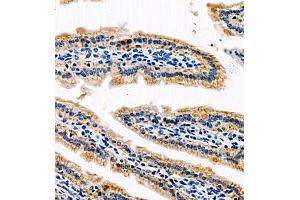 Immunohistochemistry of paraffin embedded mouse small intestine using AnnexinA13 (ABIN7073061) at dilution of 1:1500 (400x lens) (Annexin A13 antibody)