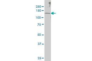 SENP6 monoclonal antibody (M01), clone 4B7 Western Blot analysis of SENP6 expression in IMR-32 . (SENP6 antibody  (AA 1-110))