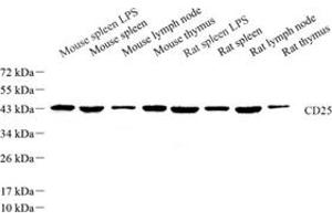 Western blot analysis of CD25 (ABIN7074349) at dilution of 1: 500 (CD25 antibody)