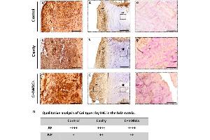 Immunohistochemistry (IHC) image for anti-Collagen, Type I (COL1) antibody (ABIN5596819)