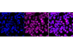 anti-Methyl-CpG Binding Domain Protein 1 (MBD1) antibody