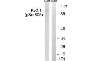 Western blot analysis of extracts from K562 cells, treated with TNF (200ng/ml, 30mins), using Kv2.