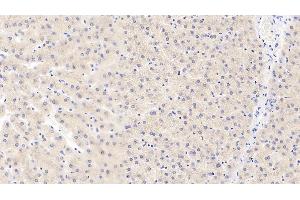 Detection of MMP3 in Human Liver Tissue using Polyclonal Antibody to Matrix Metalloproteinase 3 (MMP3) (MMP3 antibody  (AA 247-370))