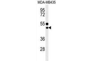 Western Blotting (WB) image for anti-CD1e (CD1e) antibody (ABIN3004387)