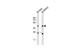 All lanes : Anti-Epcam Antibody (C-term) at 1:2000 dilution Lane 1: mouse lung lysates Lane 2: mouse kidney lysates Lysates/proteins at 20 μg per lane. (EpCAM antibody  (C-Term))