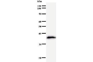 Western Blotting (WB) image for anti-Leucine Zipper, Down-Regulated in Cancer 1 (LDOC1) antibody (ABIN932190) (LDOC1 antibody)