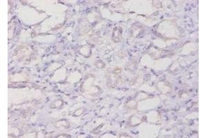 Immunohistochemistry of paraffin-embedded human kidney tissue using ABIN7152720 at dilution of 1:20 (FTL antibody  (AA 2-175))