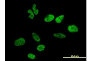 Immunofluorescence of purified MaxPab antibody to WBP11 on HeLa cell. (WBP11 antibody  (AA 1-641))