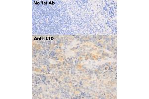 Immunohistochemistry (IHC) image for anti-Interleukin 10 (IL10) antibody (ABIN6254177) (IL-10 antibody)