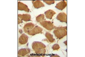CDKN1B Antibody (C-term) (ABIN657225 and ABIN2846327) immunohistochemistry analysis in formalin fixed and paraffin embedded human skeletal muscle followed by peroxidase conjugation of the secondary antibody and DAB staining. (CDKN1B antibody  (C-Term))