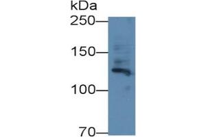 Rabbit Capture antibody from the kit in WB with Positive Control: Human Placenta lysate. (Fibrillin 1 CLIA Kit)