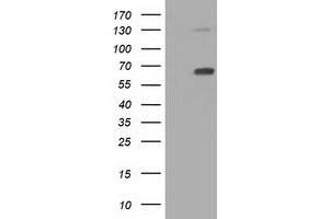 Western Blotting (WB) image for anti-Pyruvate Kinase, Liver and RBC (PKLR) antibody (ABIN1500245) (PKLR antibody)