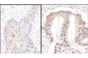 anti-Proteasome (Prosome, Macropain) 26S Subunit, Non-ATPase, 3 (PSMD3) (AA 1-50) antibody