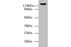 Western blot All lanes: VCL antibody at 2 μg/mL + 293T whole cell lysate Secondary Goat polyclonal to rabbit IgG at 1/10000 dilution Predicted band size: 124, 117, 25 kDa Observed band size: 124 kDa (Vinculin antibody  (AA 2-235))