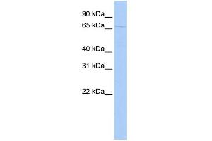 WB Suggested Anti-GSPT2 Antibody Titration: 0. (GSPT2 antibody  (N-Term))