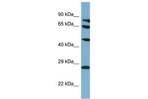 Host:  Rabbit  Target Name:  SV2B  Sample Type:  HT1080 Whole Cell lysates  Antibody Dilution:  1.