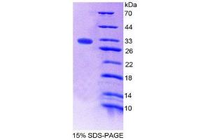 SDS-PAGE (SDS) image for Coagulation Factor XIII, A1 Polypeptide (F13A1) (AA 107-345) protein (His tag) (ABIN2124419) (F13A1 Protein (AA 107-345) (His tag))