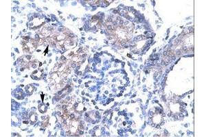 T-Box 19 antibody  (N-Term)