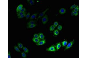 Immunofluorescent analysis of HepG2 cells using ABIN7142292 at dilution of 1:100 and Alexa Fluor 488-congugated AffiniPure Goat Anti-Rabbit IgG(H+L) (HMGCR antibody  (AA 588-887))