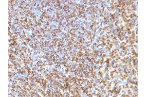 Formalin-fixed, paraffin-embedded human Spleen stained with Galectin-13 Monoclonal Antibody (PP13/1161). (LGALS13 antibody  (AA 23-134))