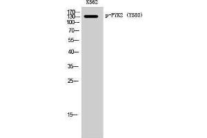 Western Blotting (WB) image for anti-PTK2B Protein tyrosine Kinase 2 beta (PTK2B) (pTyr580) antibody (ABIN3182496) (PTK2B antibody  (pTyr580))