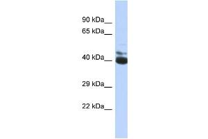 Western Blotting (WB) image for anti-FERM Domain Containing 3 (FRMD3) (C-Term) antibody (ABIN2774119) (FRMD3 antibody  (C-Term))