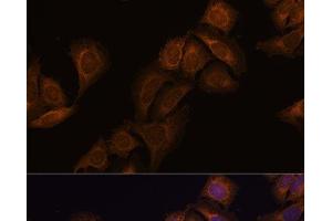 Ataxin 2 antibody