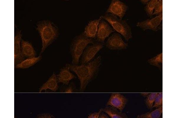 Ataxin 2 antibody