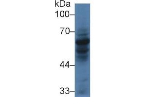 Detection of CARD9 in Human HL60 cell lysate using Polyclonal Antibody to Caspase Recruitment Domain Family, Member 9 (CARD9) (CARD9 antibody  (AA 26-283))