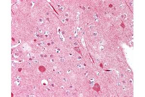 Anti-MYF5 / MYF 5 antibody IHC staining of human brain, cortex. (MYF5 antibody  (AA 7-36))