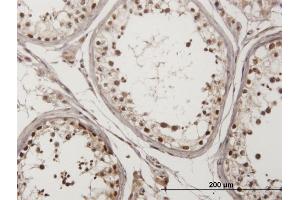 Immunoperoxidase of monoclonal antibody to CHEK2 on formalin-fixed paraffin-embedded human testis. (CHEK2 antibody  (AA 1-543))