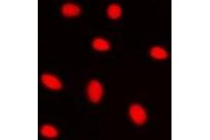 Immunofluorescent analysis of ZNF668 staining in HepG2 cells.