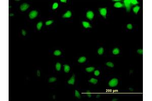 Immunofluorescence of purified MaxPab antibody to NT5C on HeLa cell. (NT5C antibody  (AA 1-117))